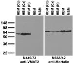 Slc18a2/VMAT2 Monoclonal Antibody (N449/73)