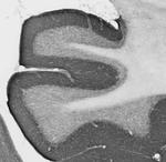 Gephyrin Monoclonal Antibody (L106/93)