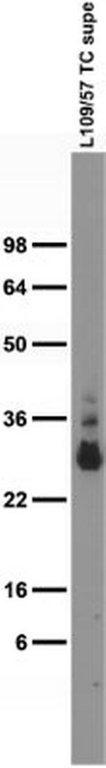 CALB1/calbindin Antibody in Western Blot (WB)