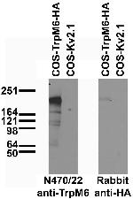 TrpM6 Antibody in Western Blot (WB)