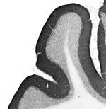 Gephyrin Antibody in Immunohistochemistry (Frozen) (IHC (F))