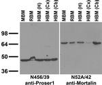 Proser1 Antibody in Western Blot (WB)