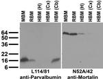 Parvalbumin Antibody in Western Blot (WB)