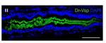 VSP/TPTE Monoclonal Antibody (N432/21)