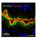 VSP/TPTE Antibody in Immunohistochemistry (Frozen) (IHC (F))