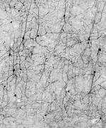 Calretinin Monoclonal Antibody (L122/6)