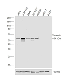 Vimentin  Antibody in Western Blot (WB)