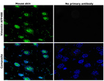 Vimentin Antibody in Immunohistochemistry (Paraffin) (IHC (P))