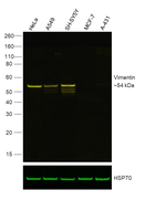 Vimentin Antibody