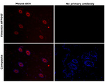Vimentin Antibody in Immunohistochemistry (Paraffin) (IHC (P))