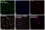 HLA-DR Recombinant Mouse Monoclonal Antibody (LN3)