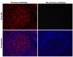 HLA-DR Antibody in Immunohistochemistry (Paraffin) (IHC (P))