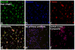 HLA-DR Antibody
