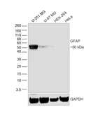 GFAP Antibody in Western Blot (WB)