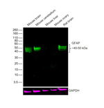 GFAP Antibody in Western Blot (WB)
