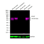 GFAP Antibody in Western Blot (WB)