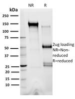 XRCC3 Monoclonal Antibody (10F1/6)