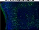 CD138 Antibody in Immunohistochemistry (Paraffin) (IHC (P))