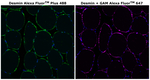 Desmin Antibody in Immunohistochemistry (Paraffin) (IHC (P))