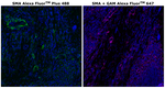 Alpha-Smooth Muscle Actin Antibody in Immunohistochemistry (Paraffin) (IHC (P))
