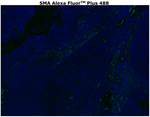 Alpha-Smooth Muscle Actin Antibody in Immunohistochemistry (Paraffin) (IHC (P))