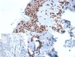 XRCC5 (Ku86/Ku80) (Thyroid-Lupus Autoantigen) Antibody in Immunohistochemistry (Paraffin) (IHC (P))