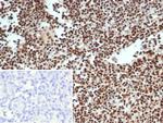 XRCC5 (Ku86/Ku80) (Thyroid-Lupus Autoantigen) Antibody in Immunohistochemistry (Paraffin) (IHC (P))
