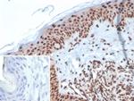 XRCC5 (Ku86/Ku80) (Thyroid-Lupus Autoantigen) Antibody in Immunohistochemistry (Paraffin) (IHC (P))