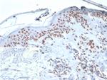XRCC5 (Ku86/Ku80) (Thyroid-Lupus Autoantigen) Antibody in Immunohistochemistry (Paraffin) (IHC (P))