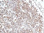 XRCC5 (Ku86/Ku80) (Thyroid-Lupus Autoantigen) Monoclonal Antibody (XRCC5/7316)