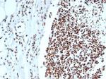 XRCC5 (Ku86/Ku80) (Thyroid-Lupus Autoantigen) Antibody in Immunohistochemistry (Paraffin) (IHC (P))