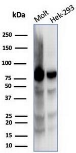XRCC5 (Ku86/Ku80) (Thyroid-Lupus Autoantigen) Antibody in Western Blot (WB)
