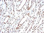 XRCC5 (Ku86/Ku80) (Thyroid-Lupus Autoantigen) Antibody in Immunohistochemistry (Paraffin) (IHC (P))