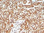 XRCC5 (Ku86/Ku80) (Thyroid-Lupus Autoantigen) Antibody in Immunohistochemistry (Paraffin) (IHC (P))