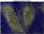 CD20 Antibody in Immunohistochemistry (Paraffin) (IHC (P))