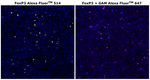 FOXP3 Antibody in Immunohistochemistry (Paraffin) (IHC (P))
