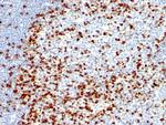 ZAP70 (Chronic Lymphocytic Leukemia Marker) Antibody in Immunohistochemistry (Paraffin) (IHC (P))