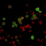 ZAP70 Monoclonal Antibody (ZAP70, 2035)