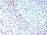 ZAP70 (Chronic Lymphocytic Leukemia Marker) Antibody in Immunohistochemistry (Paraffin) (IHC (P))