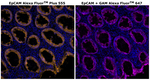 CD326 (EpCAM) Antibody in Immunohistochemistry (Paraffin) (IHC (P))