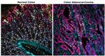 CD4 Antibody in Multiplex Immunohistochemistry (mIHC)