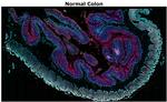 CD4 Antibody in Multiplex Immunohistochemistry (mIHC)