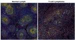CD4 Antibody in Multiplex Immunohistochemistry (mIHC)