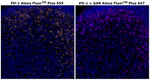 PD-1 (CD279) Antibody in Immunohistochemistry (Paraffin) (IHC (P))