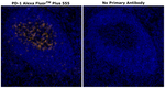 PD-1 (CD279) Antibody in Immunohistochemistry (Paraffin) (IHC (P))