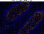 PD-1 (CD279) Antibody in Immunohistochemistry (Paraffin) (IHC (P))