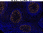 PD-1 (CD279) Antibody in Immunohistochemistry (Paraffin) (IHC (P))