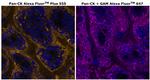 Cytokeratin Pan Type I/II Monoclonal Antibody (AE1/AE3), Alexa Fluor™ Plus 555