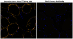 Desmin Antibody in Immunohistochemistry (Paraffin) (IHC (P))