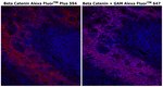 beta Catenin Antibody in Immunohistochemistry (Paraffin) (IHC (P))